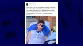 Dans un tweet du 8 avril 2022, Benjamin Hall, journaliste blessé en Ukraine, donne des nouvelles de son état de Santé