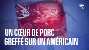  Aux États-Unis, un cœur de porc génétiquement modifié a été greffé avec succès sur un Américain 