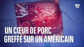  Aux États-Unis, un cœur de porc génétiquement modifié a été greffé avec succès sur un Américain 