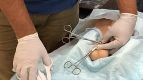 Entraînement de pratique d'une vasectomie
