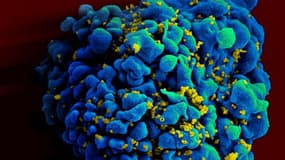 Image d'une cellule infectée par le VIH.