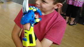 La prothèse de main "Wolverine" a vu le jour le 5 septembre dernier.