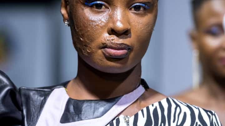 L'un des mannequins du défilé porte des cicatrices sur le visage.