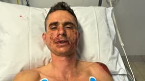 Les impressionnantes blessures de Rudy Molard après sa chute lors du Tour Down Under, le 18 janvier 2024