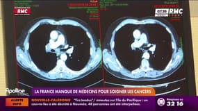La France manque de médecins pour soigner les cancers