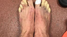 Pieds