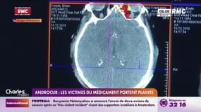 Androcur : Les victimes du médicament portent plainte