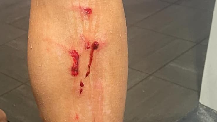 La jambe gauche de Takumi Minamino, victime du tacle de Dante lors de Nice-Monaco, 11 février 2024