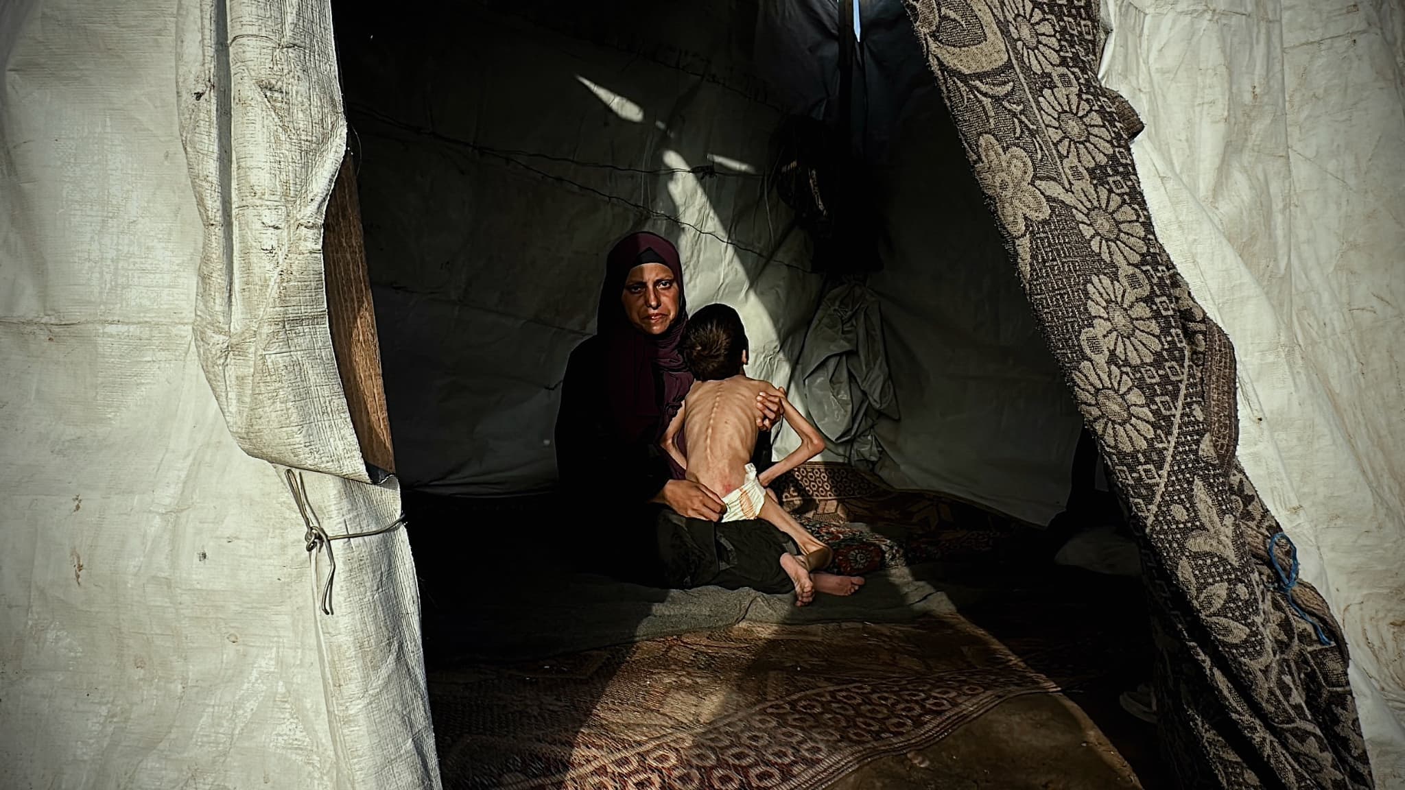 UN ENFANT SUR SIX SOUFFRE DE "MALNUTRITION AIGUË" DANS LA BANDE DE GAZA APRÈS DEUX ANS DE CONFLIT