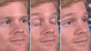 Le mème "Blinking White Guy"