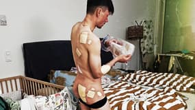Primoz Roglic poste une photo de ses blessures après le Tour du Pays basque, 7 avril 2024