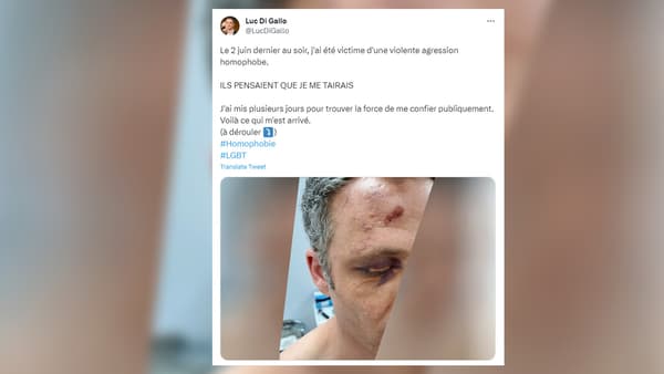 L'élu a partagé la violente agression homophobe dont il a été victime au début du mois.