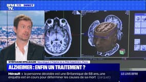 Alzheimer: enfin un traitement ? (2) - 25/10