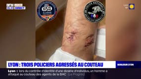 Lyon: trois policiers agressés au couteau
