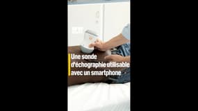Une sonde d'échographie utilisable avec un smartphone
