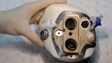 Un coeur artificiel fabriqué par la société Carmat, en 2009 à Vélizy-Villacoublay