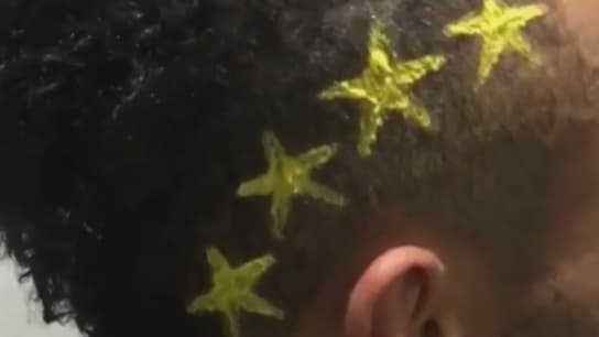 La nouvelle coupe de Pierre-Emerick Aubameyang (Borussia Dortmund) est visible... même dans le noir.