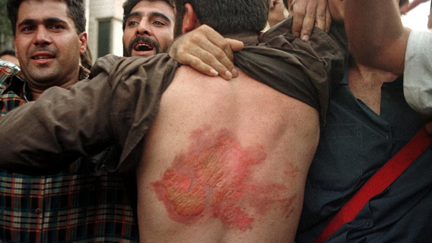 Un étudiant participant à une manifestation le 10 juillet 1999 à Téhéran contre les restrictions de la presse montre des blessures infligées lors de heurts avec les Islamistes