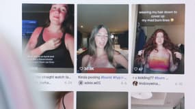 La tendance des tan lines inquiète les professionnels de santé.