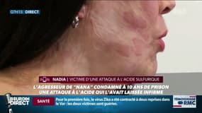 Nadia, brûlée à l’acide réagit au verdict du procès: "Je suis mutilée à vie, j'ai pris perpétuité... et lui il a pris 10 ans..."