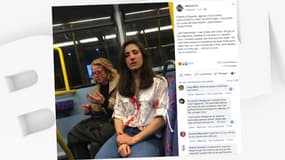 Melania Geymonat a dévoilé sur Facebook la photographie de son visage ensanglanté, et de celui de sa petite amie Chris, après avoir été attaquées dans un bus londonien. 
