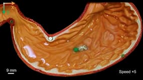 Un micro robot appliqué dans le domaine de la santé