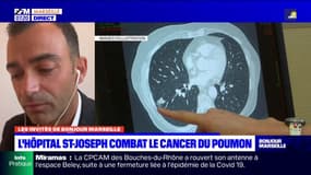 Bouches-du-Rhône: la Ligue contre le cancer va financer le dépistage du cancer du poumon