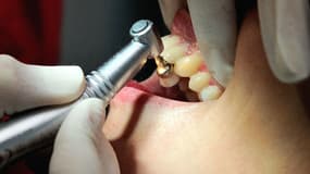 Les dentistes affirment que le gel des tarifs de la Sécu les conduit à "compenser" sur les actes à honoraires libres.