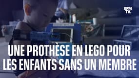  Une prothèse en lego pour aider les enfants nés sans un membre