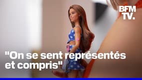 Mattel lance sa première poupée Barbie atteinte de diabète de type 1