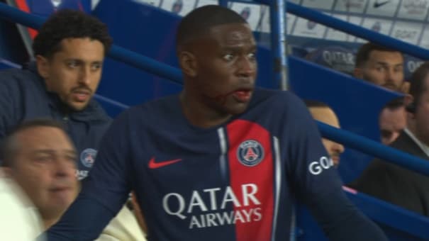 Nordi Mukiele, visage en sang, au moment de sa sortie, PSG-Clermont, 6 avril 2024