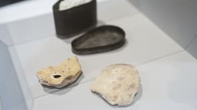 Les fragments de crâne appartenant possiblement à Ludwig van Beethoven exposés à l'Université de médecine de Vienne, le 20 juillet 2023.