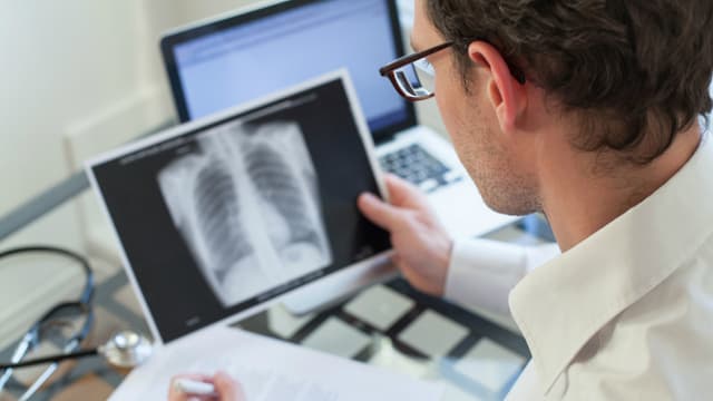 La tuberculose est une maladie infectieuse due au bacille de Koch, le plus souvent pulmonaire