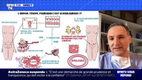 L'endométriose bientôt reconnue comme affection longue durée ? BFMTV répond à vos questions