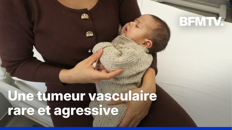 Ce bébé a été sauvé d'une tumeur grâce à un traitement prénatal