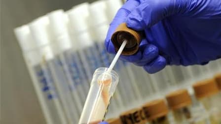 Analyse de bactérie E. coli. L'Escherichia coli à l'origine d'une flambée épidémique meurtrière en Allemagne est une nouvelle souche bactérienne hautement toxique, rapportent des scientifiques, alors que des cas signalés aux Etats-Unis alimentent les inqu
