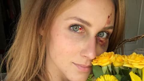 Les clichés montrent le visage tuméfié de la jeune femme