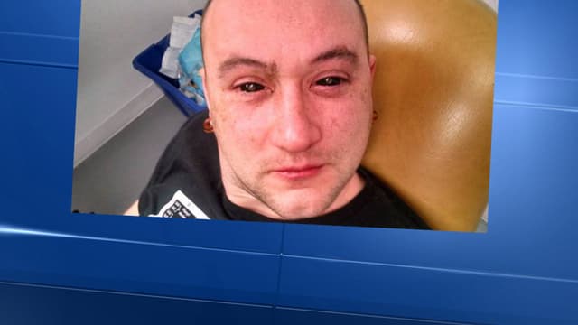 Gabriel Licina, biohacker et scientifique indépendant, a payé de sa personne pour l'expérience.