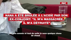 Nana a été brûlée à l'acide par son ex-conjoint: "Il m'a massacrée, il m'a mutilée, il m'a détruite"