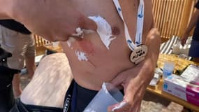 Un nageur piqué par une méduse lors du Défi Monte Cristo à Marseille ce dimanche