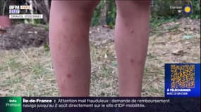 Essonne: alerte aux moustiques tigres après un cas d'arbovirose détecté