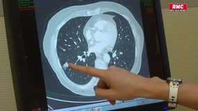 Santé : Le nombre de cancers grimpe en flèche en France