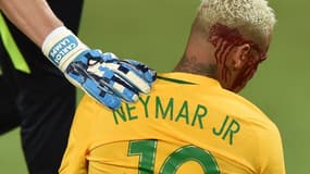 Neymar le visage en sang