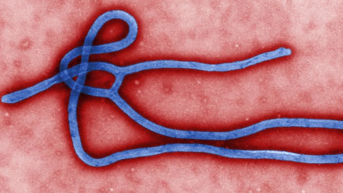Microscopie électronique d'un virus Ebola.