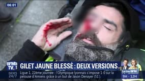 Gilets jaunes: les deux versions qui s'opposent sur la blessure à l’œil de Jérôme Rodrigues