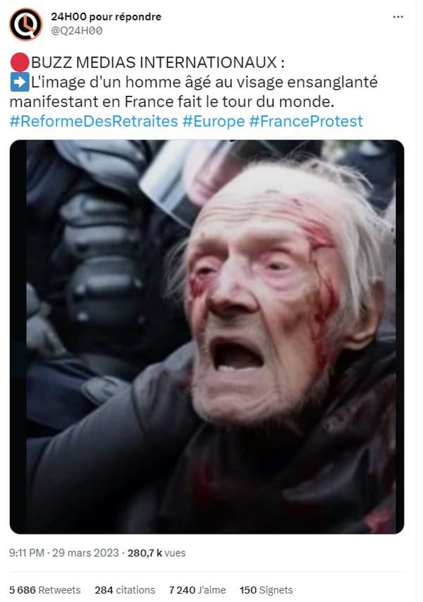 Cette image de "manifestant blessé" a été générée par intelligence artificielle, mais des tweets l'ont présentée comme véridique