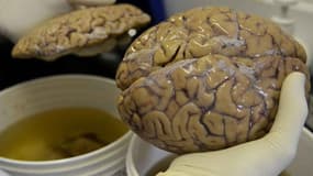 Un scientifique manipule un cerveau dans un laboratoire de Medellin, en Colombie.