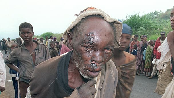 Rescapés du génocide rwandais, en 1994.