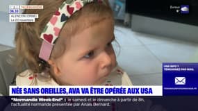 Alençon: une cagnotte en ligne ouverte pour financer l'opération d'une enfant souffrant d'une malformation aux oreilles