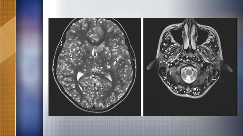 Des images de l'infestation